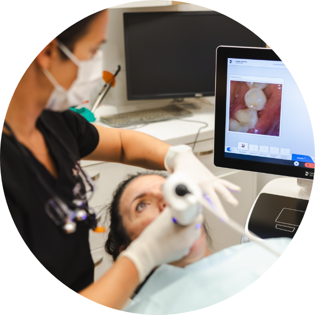 CEREC Prime scan CEREC Prime scan